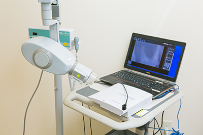 歯科用CCDデジタルＸ線画像システム